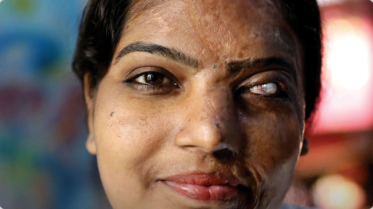 Close-up portrait from Design Hierarchy’s social impact work